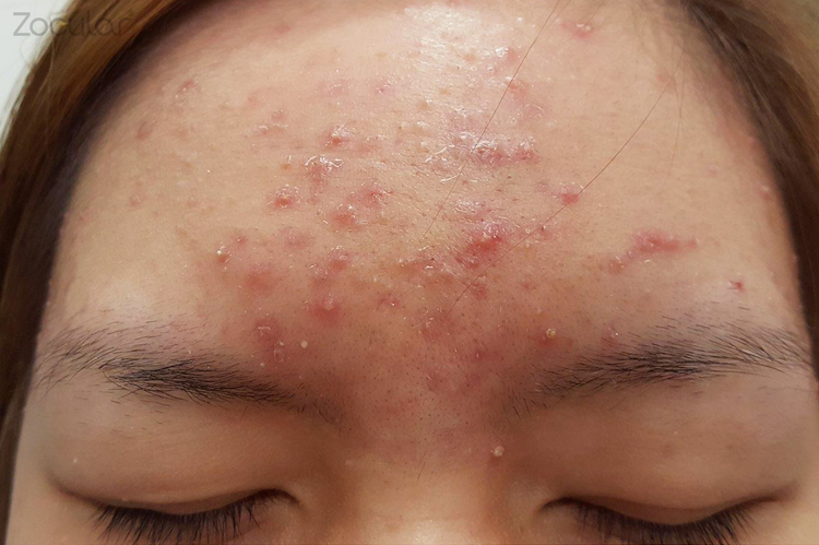 Zocular | The Power of Okra Complex for Eyecare and Skincare